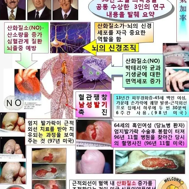 자궁.전립선.근적외선아자궁