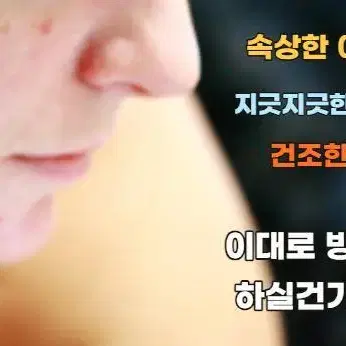 여드름비누 10개 지루성피부염 등드름 좁쌀 청소년여드름 어성초 세안비누