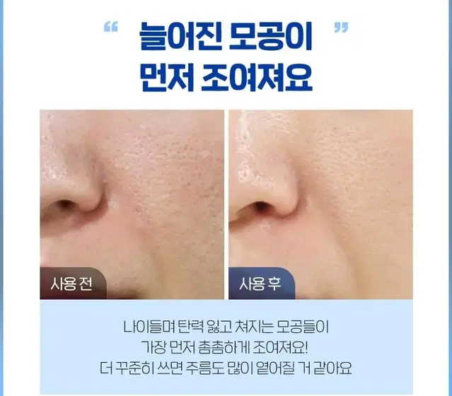 피부과X한번만발라도 효과팔자 주름 기미 탄력 줄기세포배양액 100% 앰플