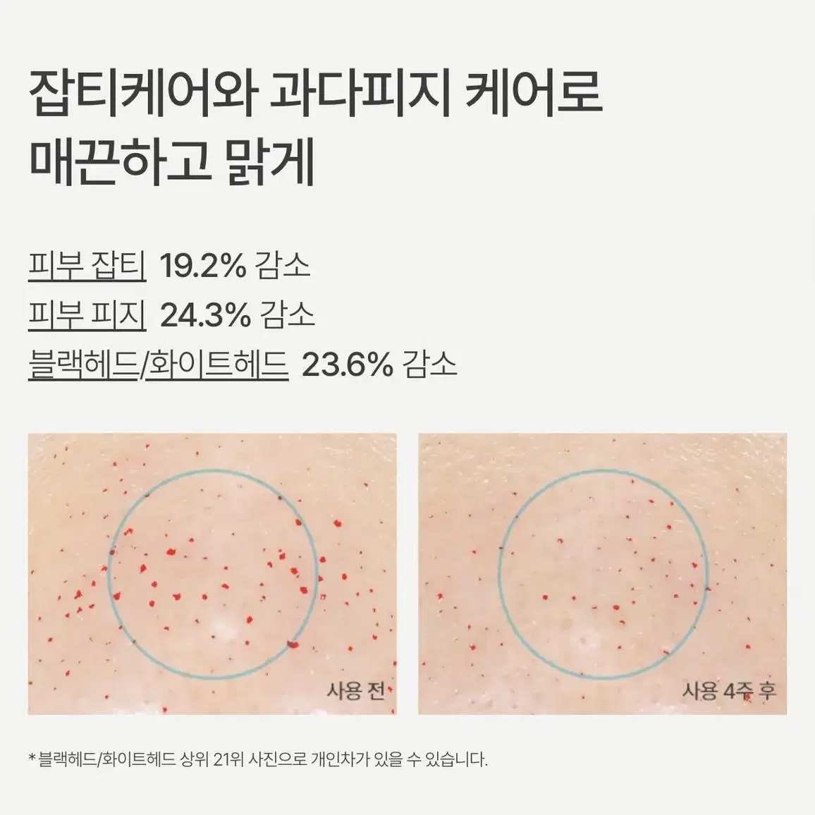 이니스프리 레티놀 시카 흔적 앰플