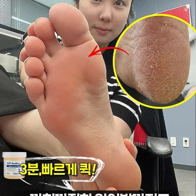 메디필 티눈크림  보들발 허니 풋톡스