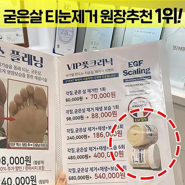 메디필 티눈크림  보들발 허니 풋톡스