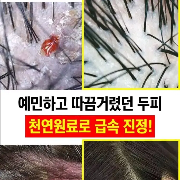 포고니아 정화샴푸  두피케어샴푸