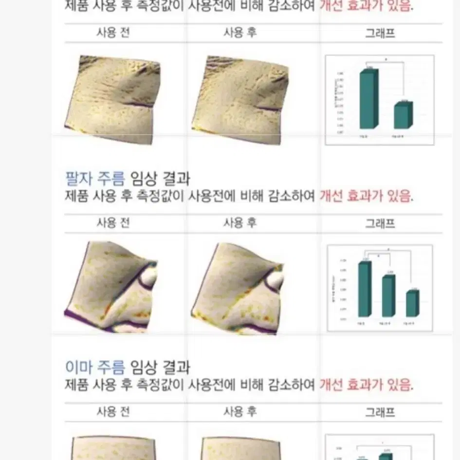 한번만 발라도 효과보장 팔자 주름 기미 탄력 줄기세포배양액 100% 앰플