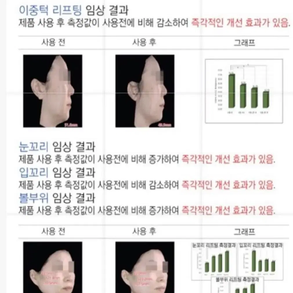 한번만 발라도 효과보장 팔자 주름 기미 탄력 줄기세포배양액 100% 앰플