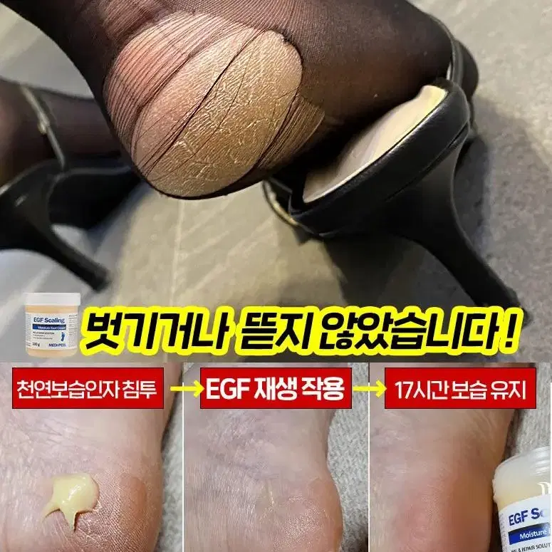 메디필 티눈크림 발각질크림