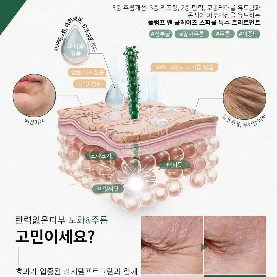 [새상품]라시뎀 링클스피큘 단품 구매수량별할인