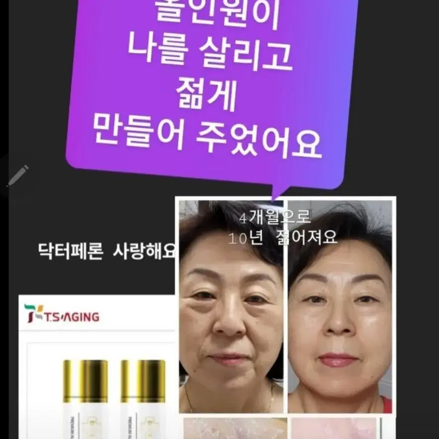 10년젊어짐