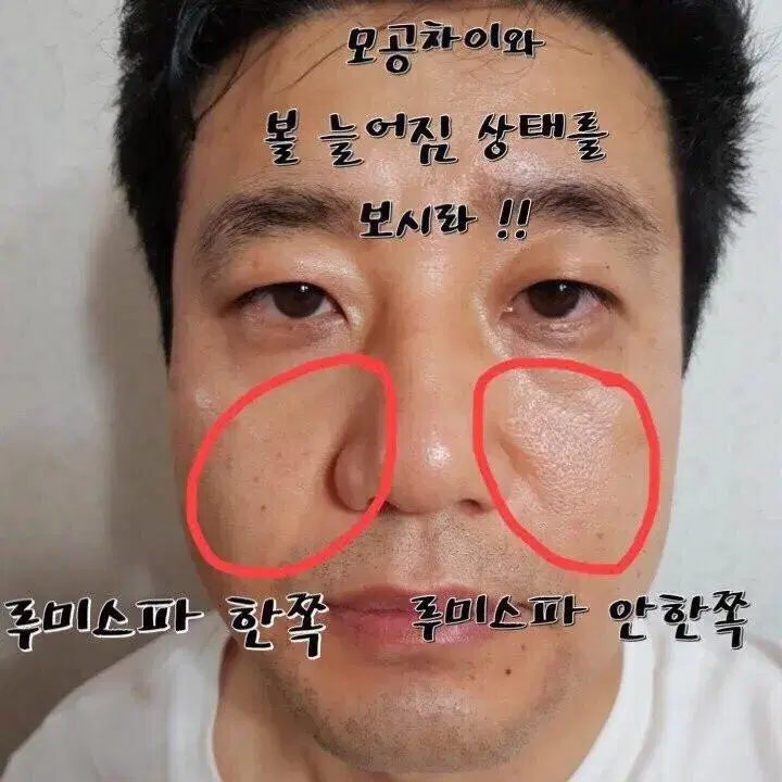 루미스파io 디바이스 할인가 판매