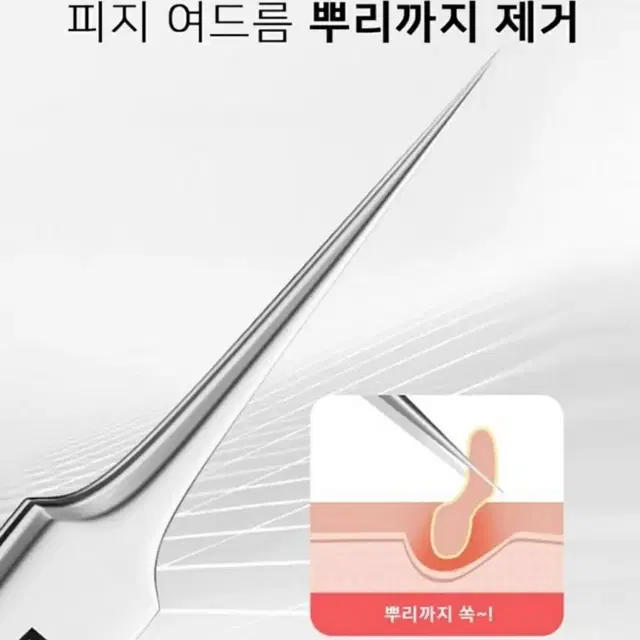 피지 갈고리 집게 여드름 압출 3종 세트