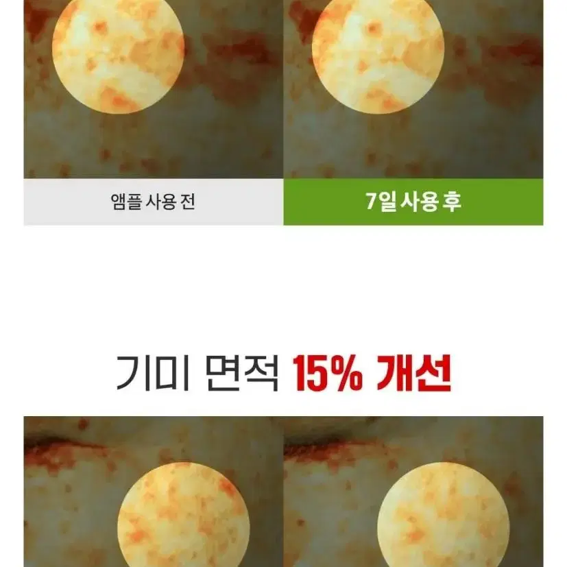 항산화 블루라이트 멜라닌 차단 활성산소 억제 고기능성 미백 동안 세럼