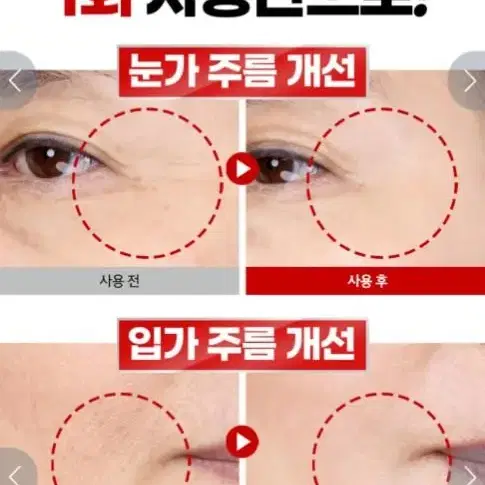 최초특허 피부세포침투단1회 사용으로 눈밑꺼짐 팔자주름 개선 바르는 보톡스