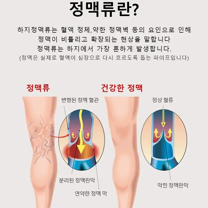 종아리 압박 밴드 스타킹 간호사 승무원 임산부 다리 수면 블랙1+베이지1