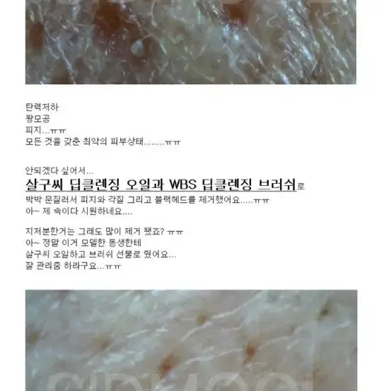 새상품)딥클렌징 블랙헤드 브러쉬 피부관리 클렌저 모공 클렌징 세안 스크럽