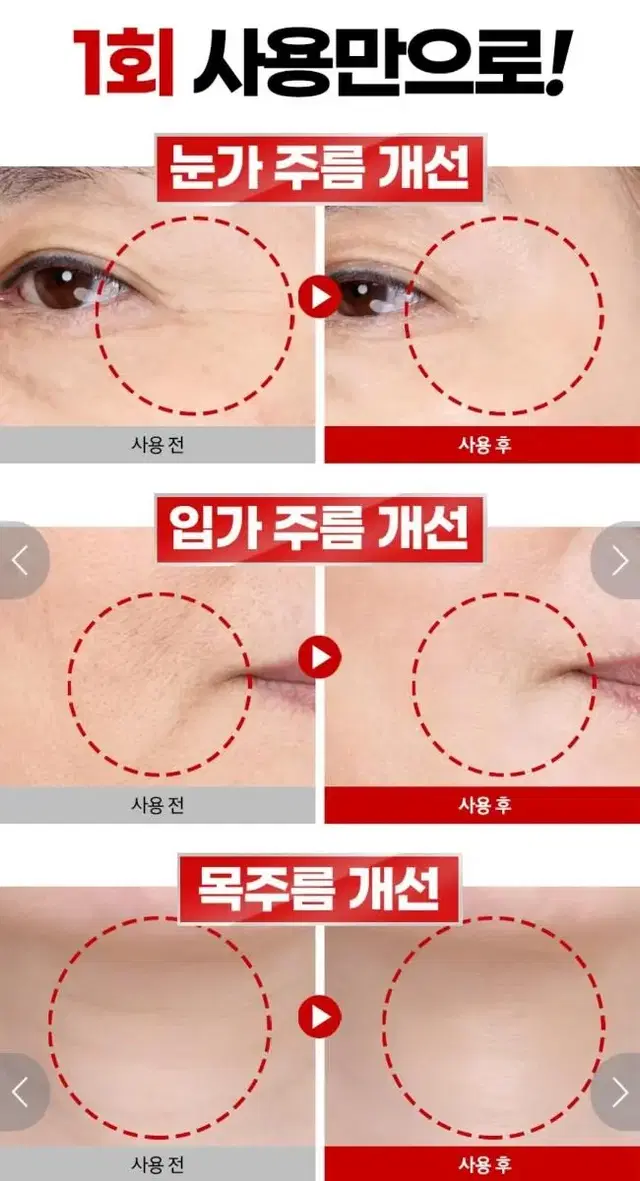 최초특허 피부세포침투단1회 사용으로 눈밑꺼짐 팔자주름 개선 바르는 보톡스