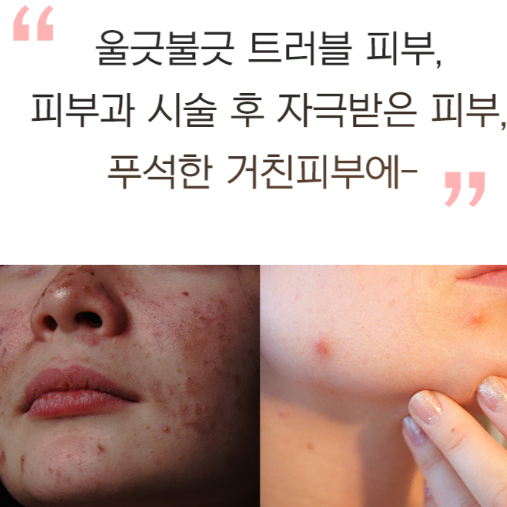 [더마겐] 라포라피 시카케어 끝판왕 센텔레이즈연고 50g(흉터치료연고)