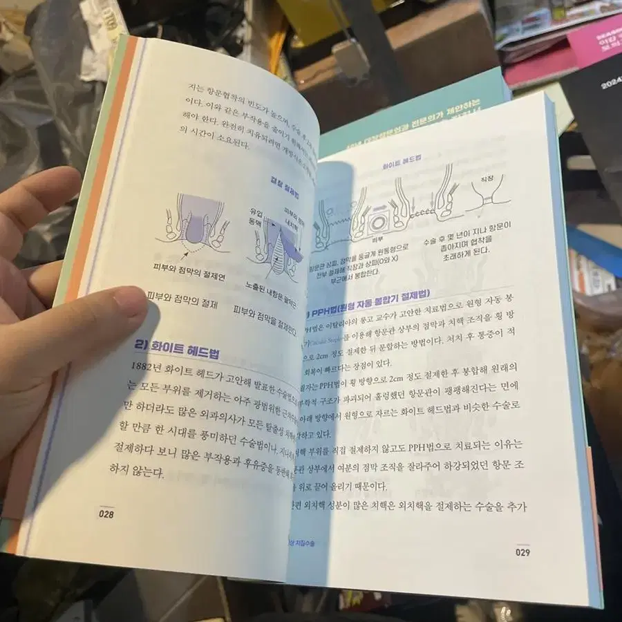 치질 해방, 거상 치질수술 책