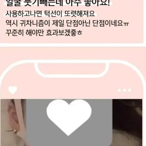 루디아 리프팅 브이밴드 의료용실리콘