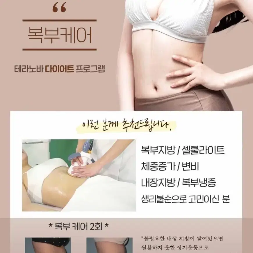 로이 에스테틱 회원권 양도