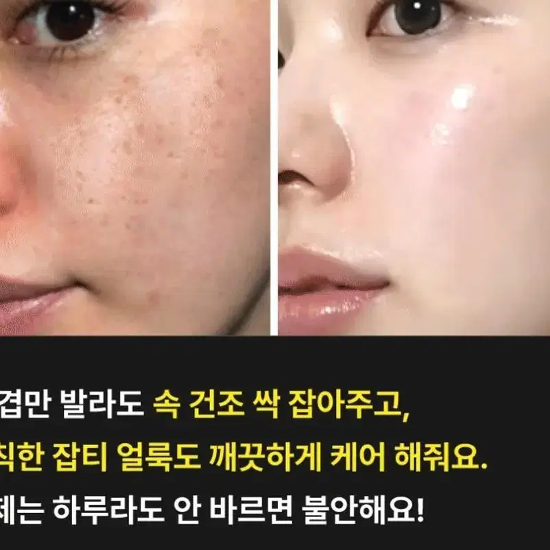 EGF특허바이오회사 극강의 탱탱함비결 비쿠치올 미백 수분 탄력 결광 크림