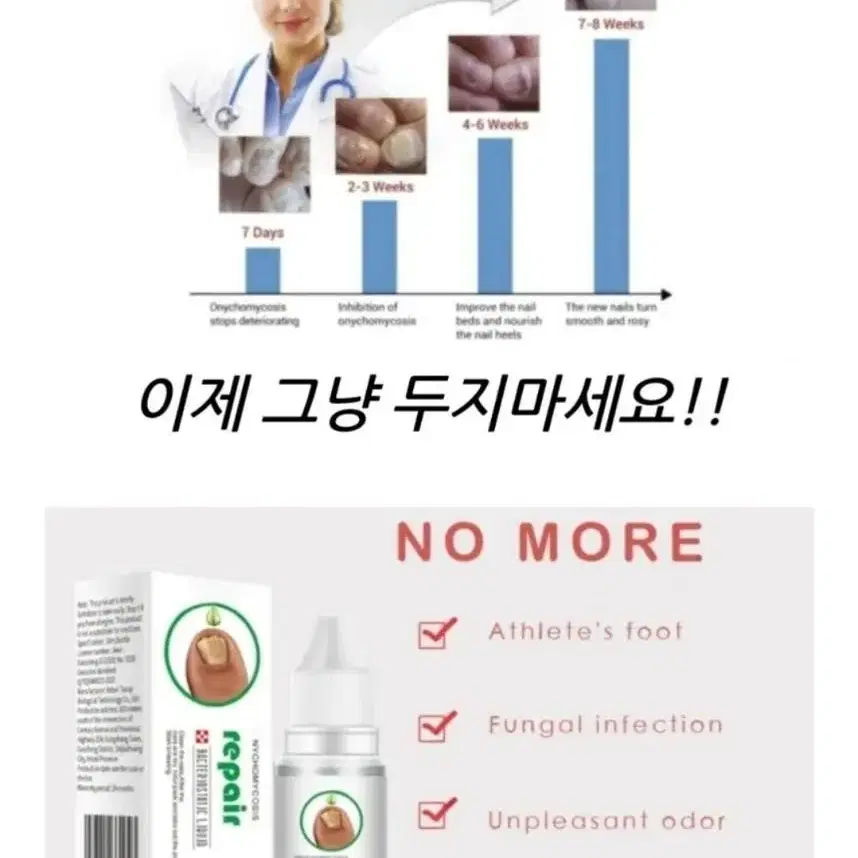 2일배송 발톱 무좀 치료 발톱 무좀 연고 진균제 손톱 염증 약