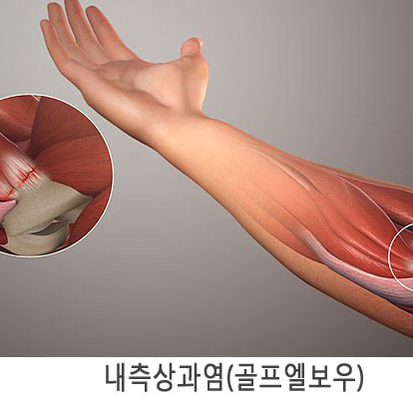 무배 물치과 추천 헬스 팔꿈치 보호대 2개 세트 헬스용품 보호대 웨이트