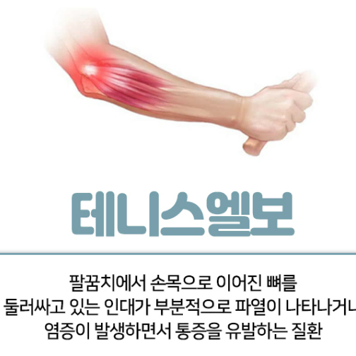 무배 물치과 추천 헬스 팔꿈치 보호대 2개 세트 헬스용품 보호대 웨이트