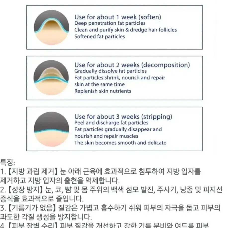 2일배송 비립종 제거 연고 율무크림 한관종