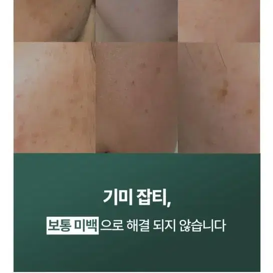 기미앰플