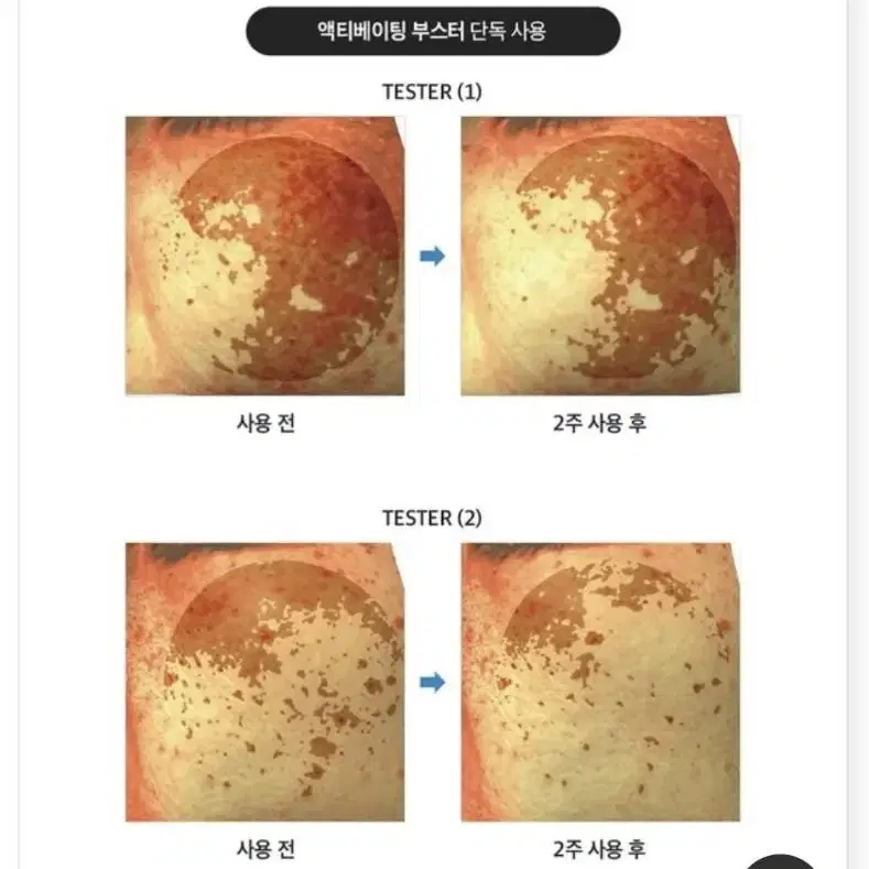 라비앙 172달톤 바르는즉시효과 콜라겐 앰플 모공 기미 잡티 주름 리프팅