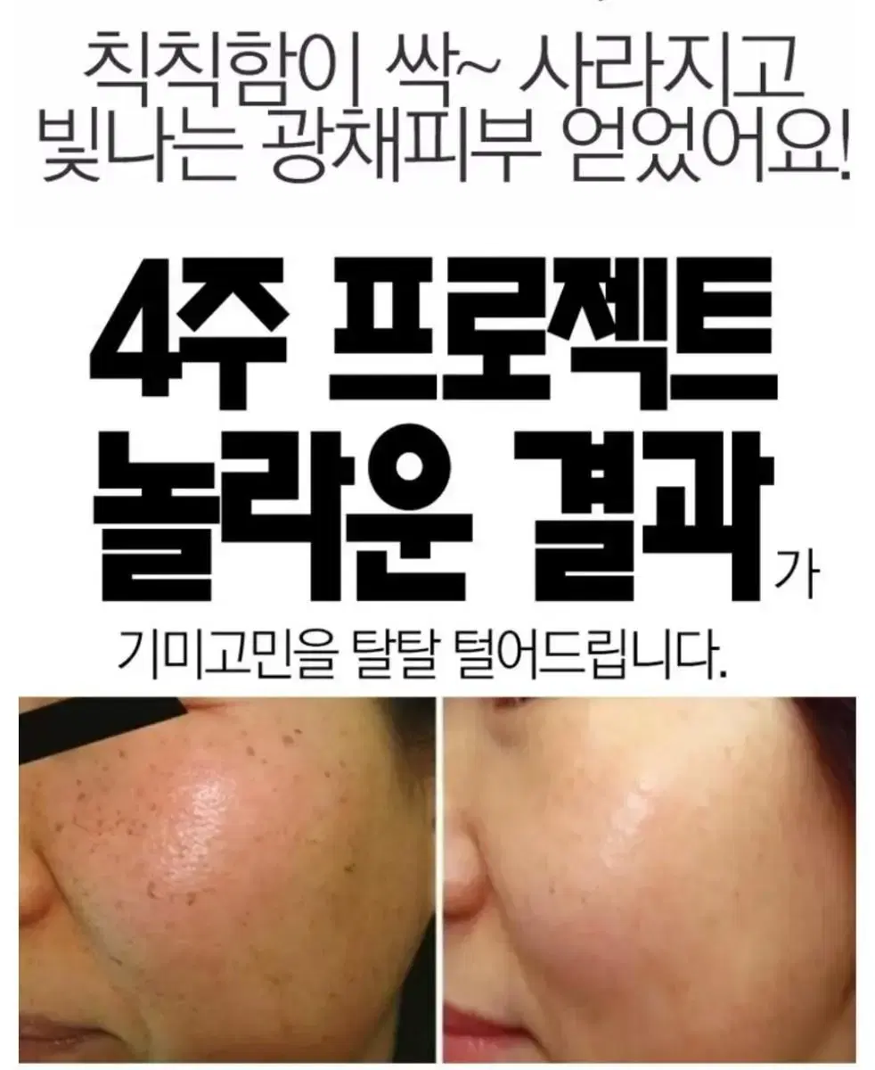 항산화 블루라이트 멜라닌 차단 활성산소 억제 고기능성 미백 동안 세럼