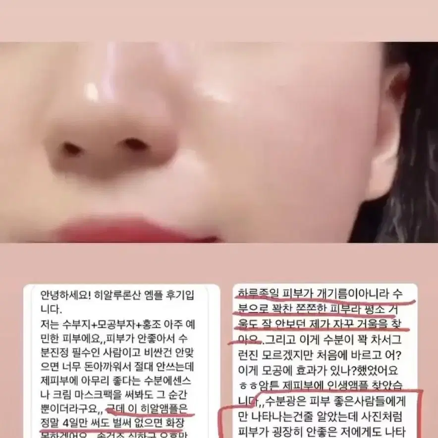 아네로즈 로즈팩토리 로즈니 양진 히알루론산앰플