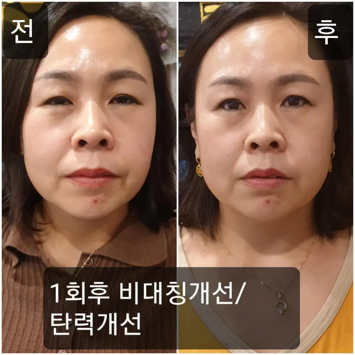 연세헬스케어