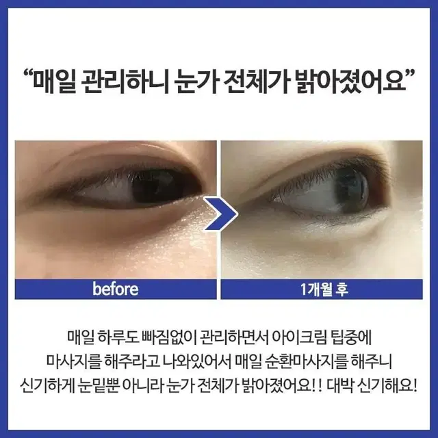 보톡스 효과 정제수0%6억 초고가원료 나노단위 역대급 모공 피부결 주름