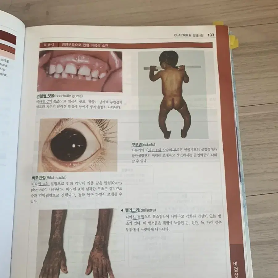 건강사정(무료배송)