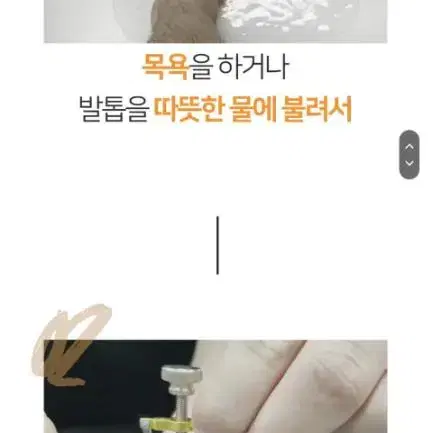 내향성발톱 내성발톱 교정기 발통증 발가락통증 발통증