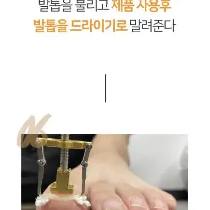 내향성발톱 내성발톱 교정기 발통증 발가락통증 발통증