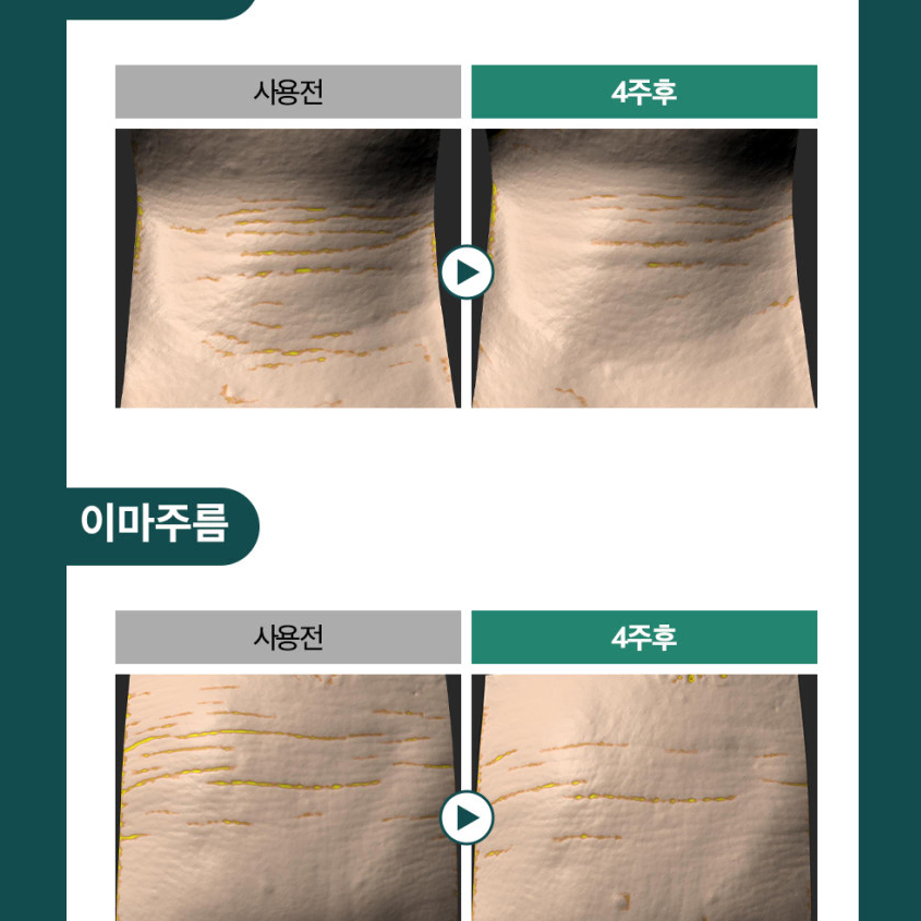 미백,주름개선 기능성 화장품 엔프라니 보타레티놀 유스 리페어 솔루션