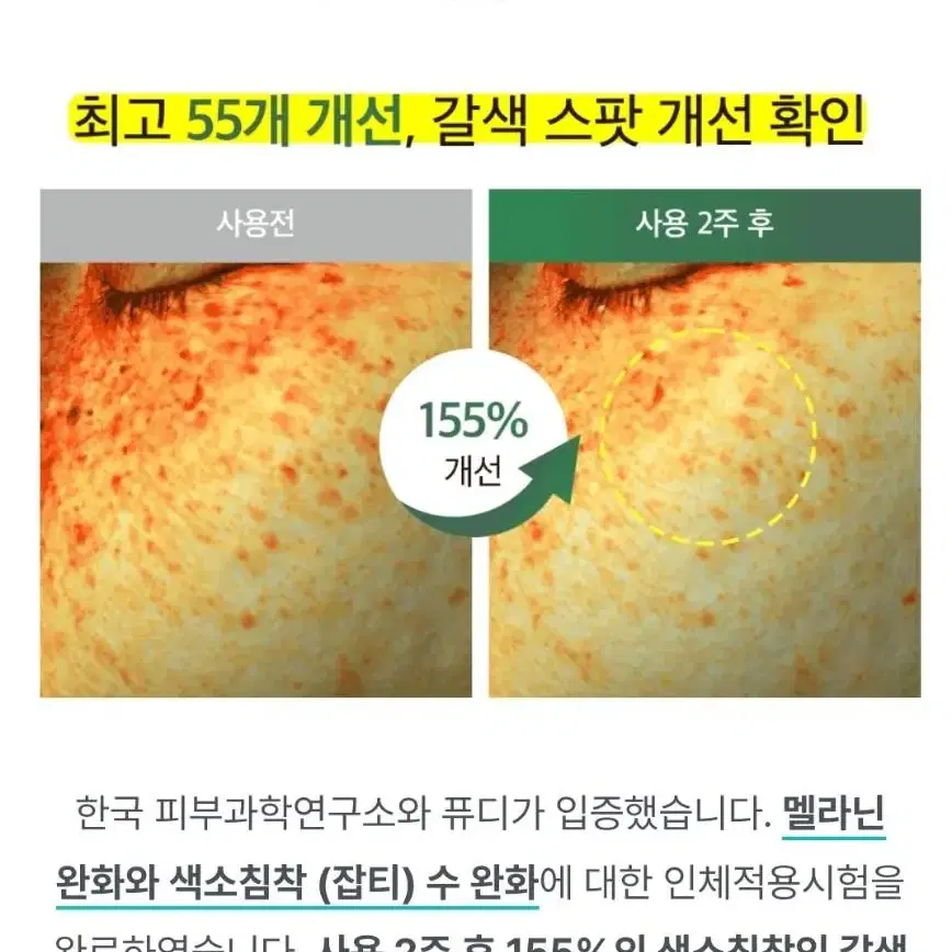 2주만에 색소침착  잡티 감소 피부자극없는 멜라토닝 미백 앰플