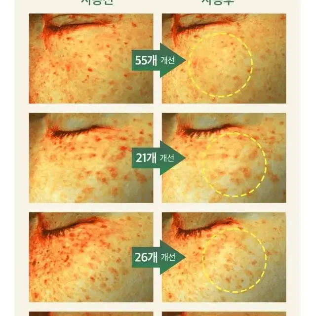 2주만에 색소침착  잡티 감소 피부자극없는 멜라토닝 미백 앰플