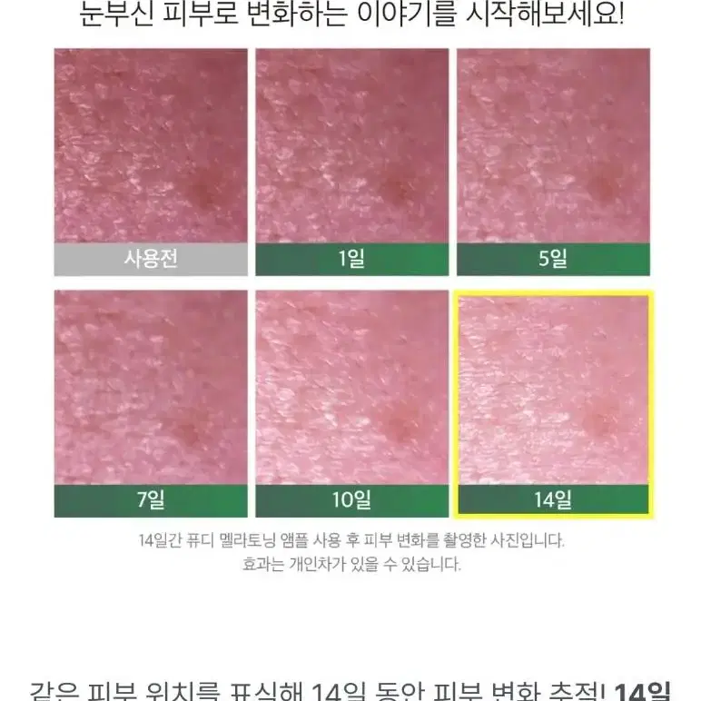 2주만에 색소침착  잡티 감소 피부자극없는 멜라토닝 미백 앰플