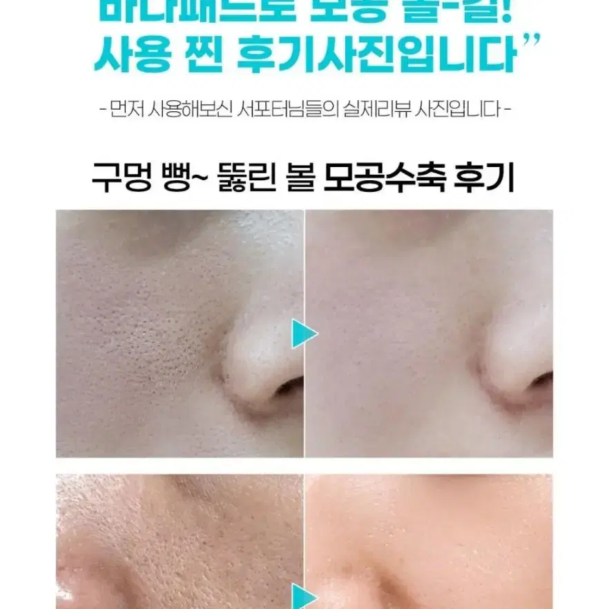 앰플40병분 각질 수분 모공 샤르드 하와이해양심층수 바다 대왕 토너패드