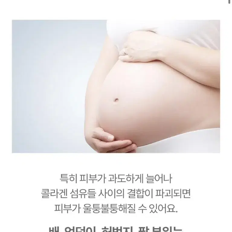 아토팜 튼살크림 새상품