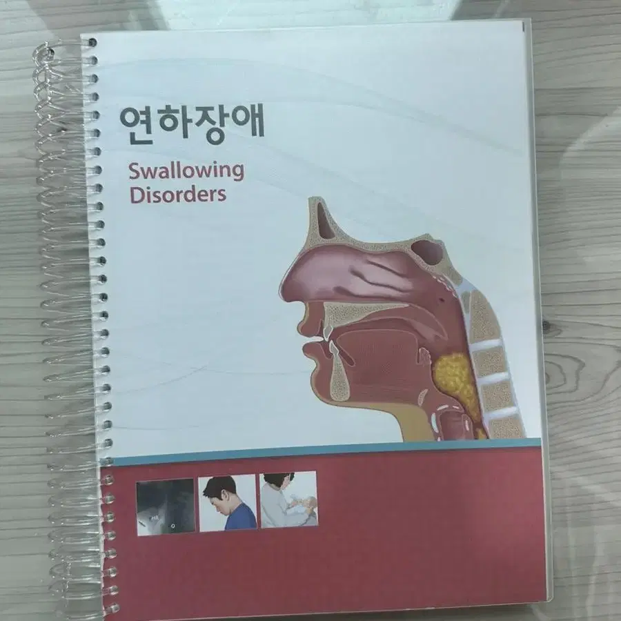 연하장애 (Swallowing Disorders)