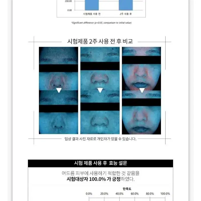 최신제조상품 새상품 베몽테스 악신 부스터 크림 뾰루지 피지조절 진정