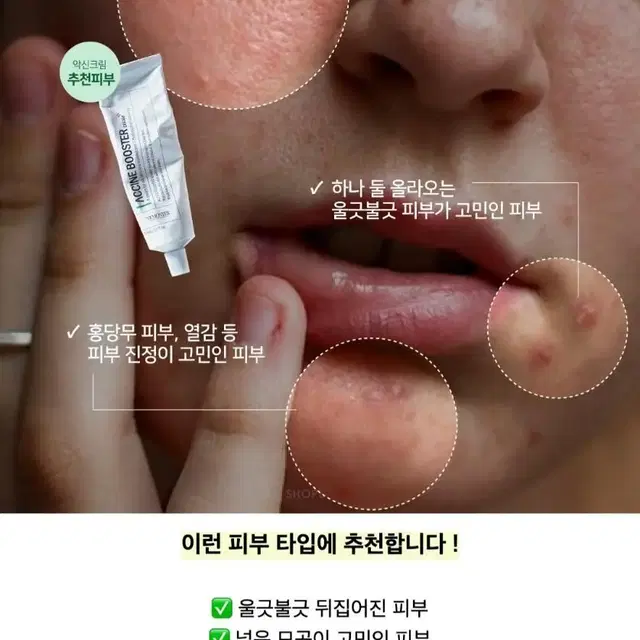 최신제조상품 새상품 베몽테스 악신 부스터 크림 뾰루지 피지조절 진정