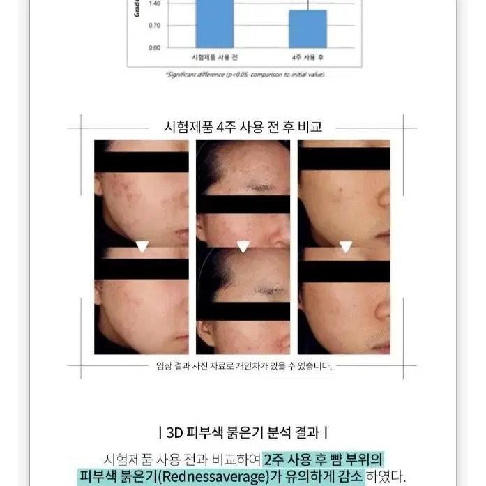 최신제조상품 새상품 베몽테스 악신 부스터 크림 뾰루지 피지조절 진정