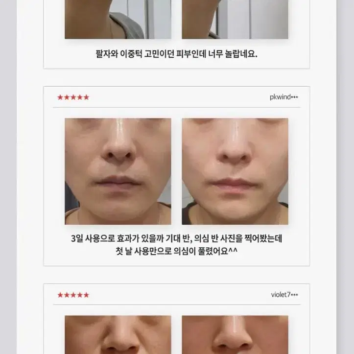 라비앙 메디닉라인 미라클 스핑고좀 주름 탄력 모공 팔자 엑소좀 크림