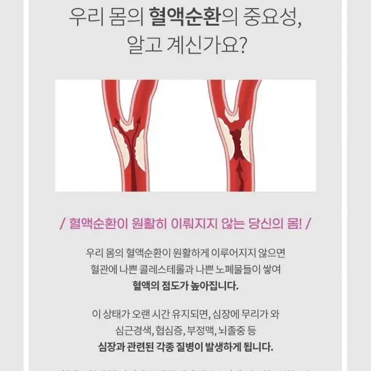 ㅡ(새상품) 레드밸런스 침매트 코코넛 (세트) 혈액순환 마사지매트 침술