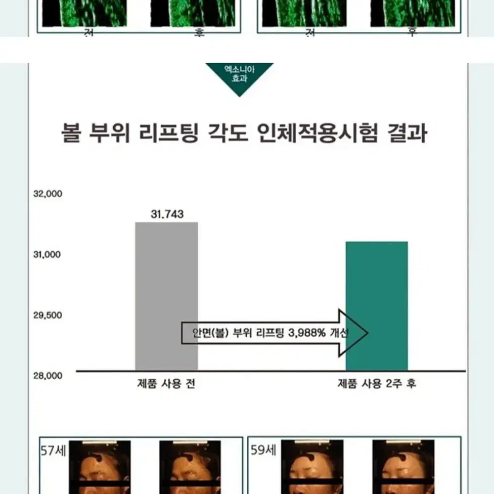 하나땡처리! 미사용 선물가능 프리미엄 셀시그널 엑소좀 크림 프로그램1박스